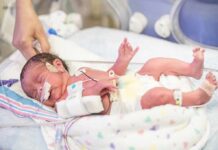 Premature newborn in NICU with monitoring tubes